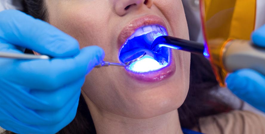 teeth-whitening