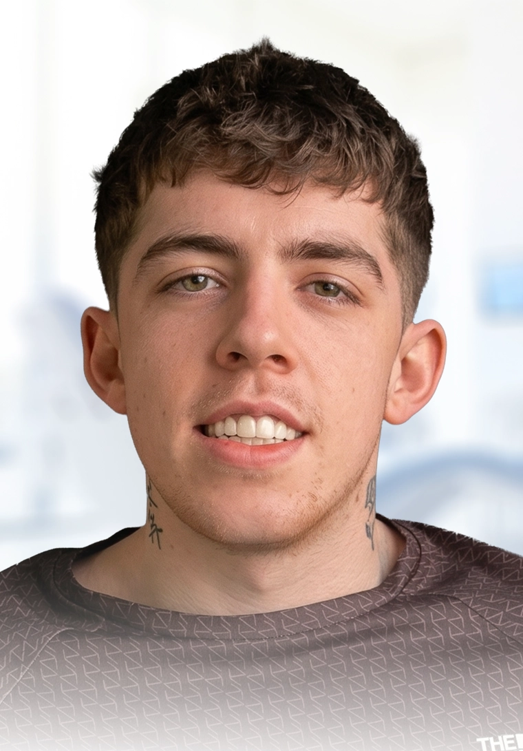 E-max Veneers